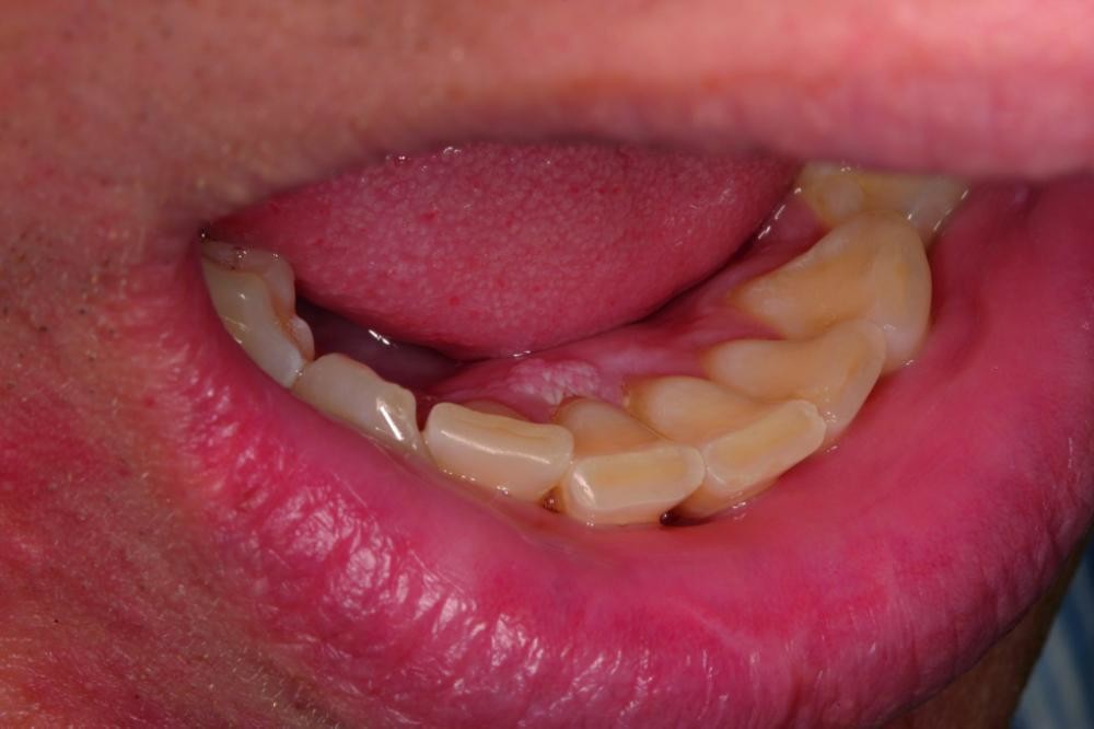 Anemia Gums And Your Oral Health My BEST Dentists Journal