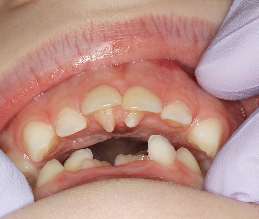 Dental anomalies, what is referred? And what should be? My BEST