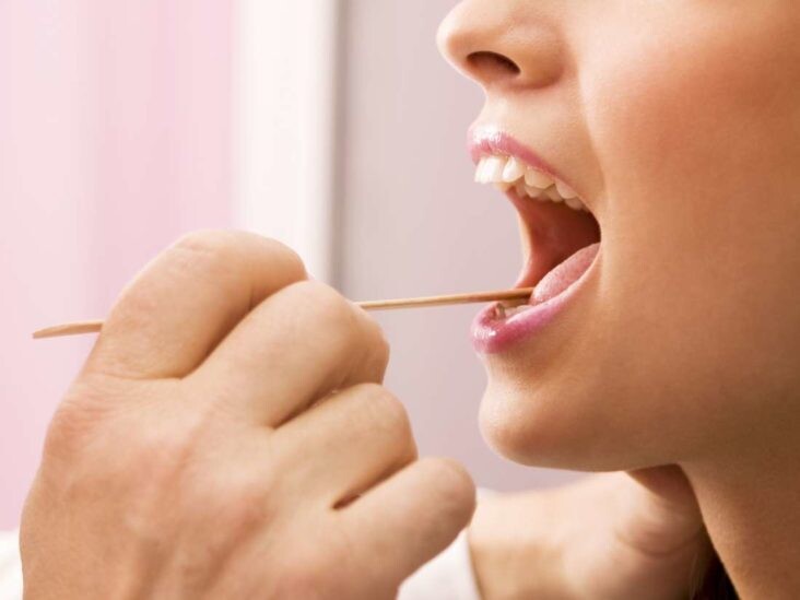 Bleeding Tongue Causes, Treatments And Remedies My BEST Dentists