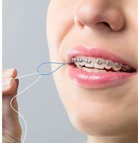 Floshing Thread Using a Floss Threader: Flossing Made Easier - My BEST Dentists Journal ...