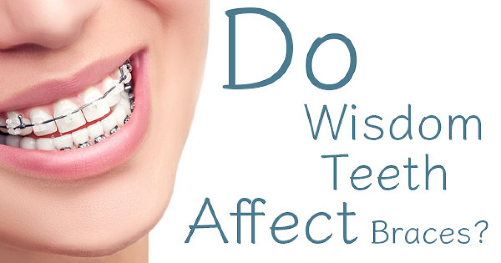 Do Wisdom teeth affect braces? My BEST Dentists Journal MyBestDentists
