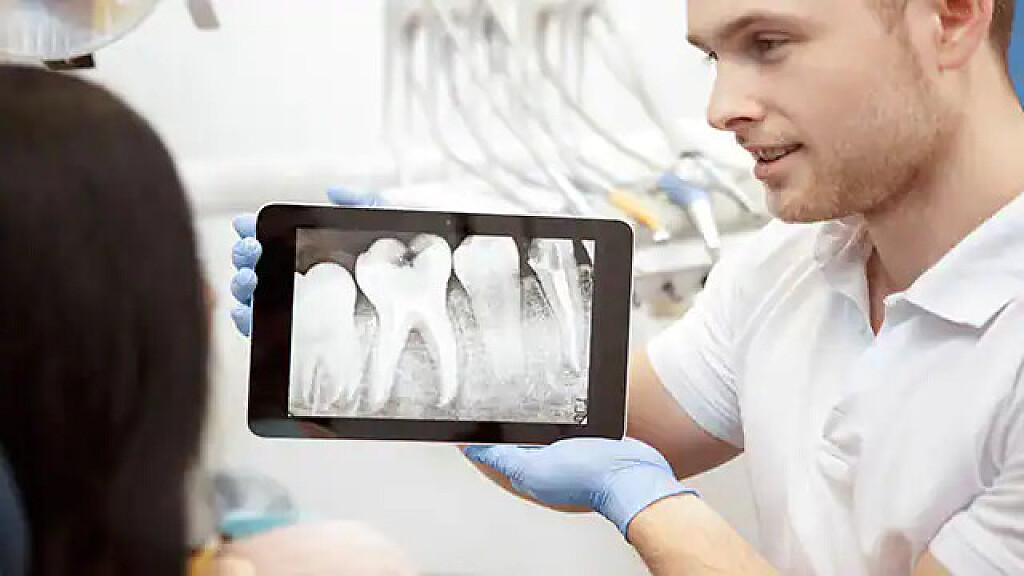 What Is Tooth Dilaceration? - My BEST Dentists Journal - MyBestDentists